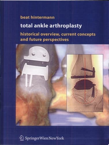 Total Ankle Arthroplasty Historical Overview, Current Concepts and Future Perspectives