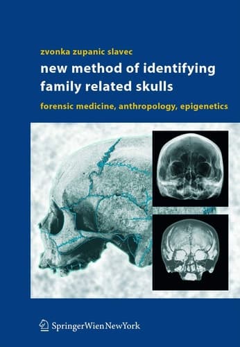 New Method of Identifying Family Related Skulls Forensic Medicine, Anthropology, Epigenetics
