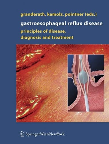 Gastroesophageal Reflux Disease Principles of Disease, Diagnosis, and Treatment