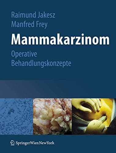 Mammakarzinom Operative Behandlungskonzepte