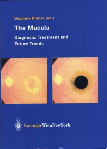 The Macula Diagnosis, Treatment and Future Trends