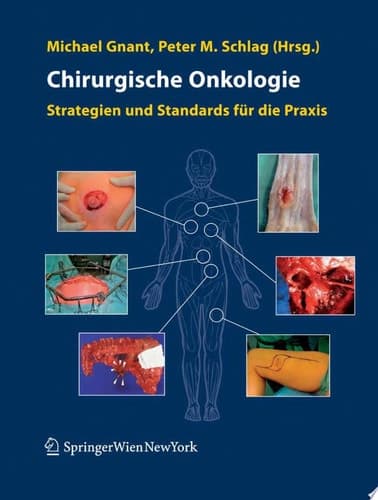 Chirurgische Onkologie Strategien und Standards für die Praxis
