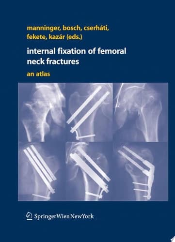 Internal fixation of femoral neck fractures An Atlas