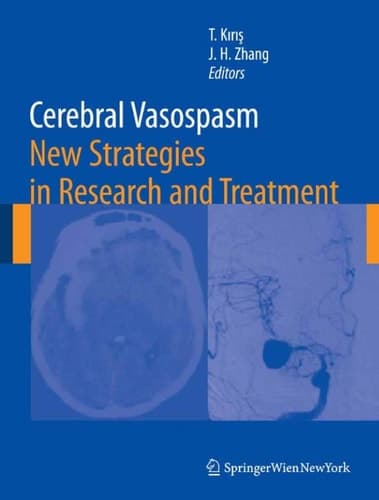 Cerebral Vasospasm New Strategies in Research and Treatment