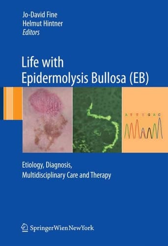 Life with Epidermolysis Bullosa (EB) Etiology, Diagnosis, Multidisciplinary Care and Therapy