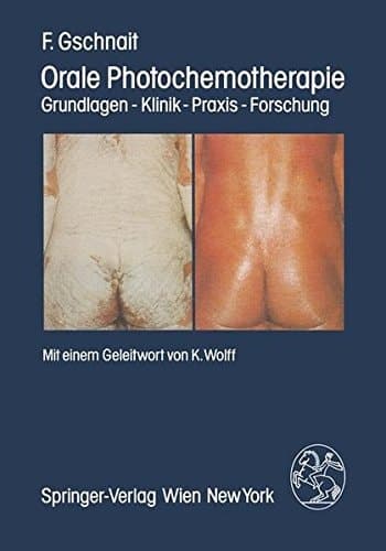 Orale Photochemotherapie Grundlagen — Klinik — Praxis — Forschung
