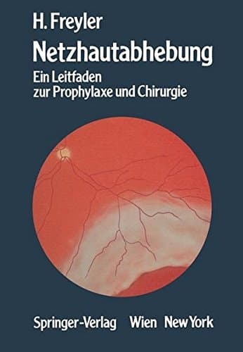 Netzhautabhebung Ein Leitfaden zur Prophylaxe und Chirurgie