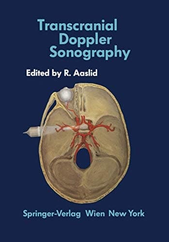 Transcranial Doppler Sonography