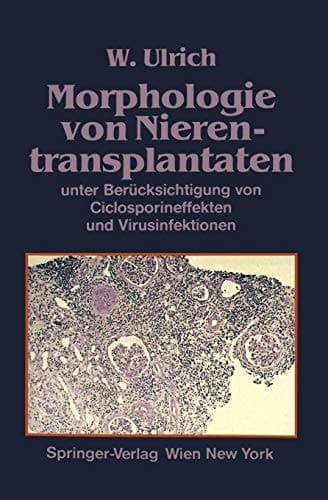 Morphologie von Nierentransplantaten unter Berücksichtigung von Ciclosporineffekten und Virusinfektionen