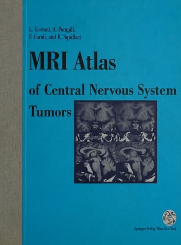 MRI Atlas of Central Nervous System Tumors