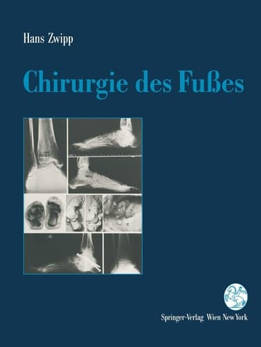 Chirurgie des Fusses