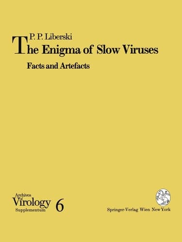 The Enigma of Slow Viruses Facts and Artefacts