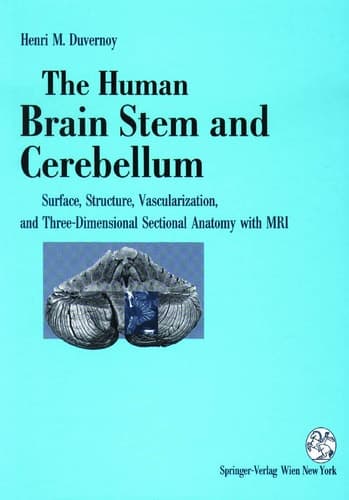 The Human Brain Stem and Cerebellum Surface, Structure, Vascularization, and Three-Dimensional Sectional Anatomy, with MRI