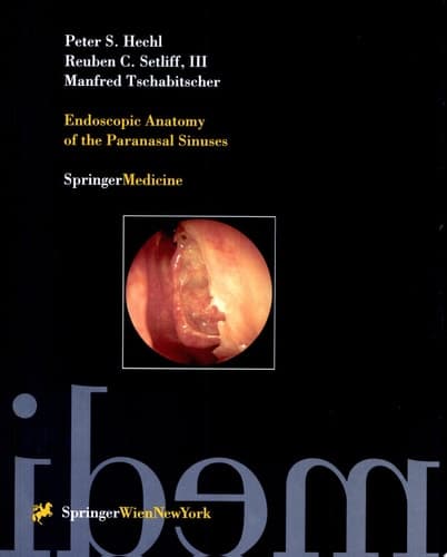 Endoscopic Anatomy of the Paranasal Sinuses