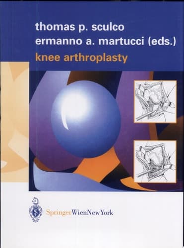 Knee Arthroplasty