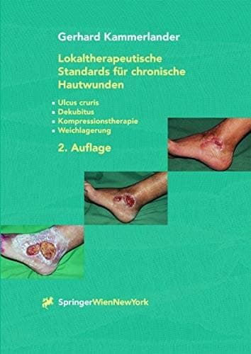 Lokaltherapeutische Standards für chronische Hautwunden Ulcus cruris - Dekubitus - Kompressionstherapie - Weichlagerung