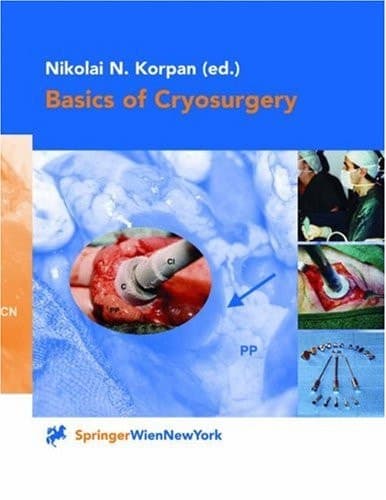 Basics of Cryosurgery