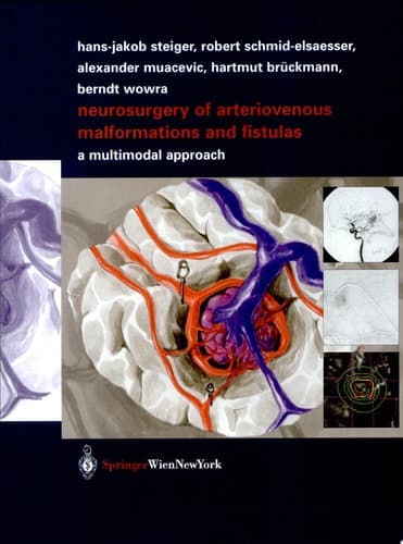 Neurosurgery of Arteriovenous Malformations and Fistulas A Multimodal Approach