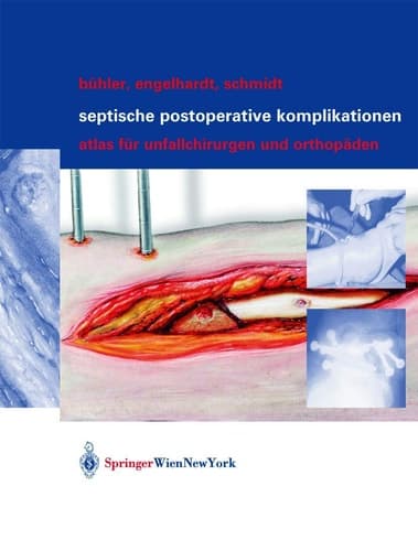 Septische postoperative Komplikationen Atlas für Unfallchirurgen und Orthopäden
