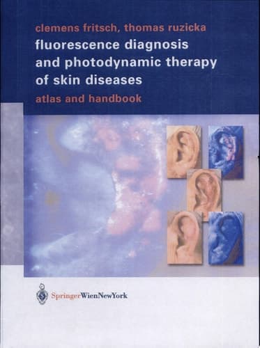 Fluorescence Diagnosis and Photodynamic Therapy of Skin Diseases Handbook and Atlas