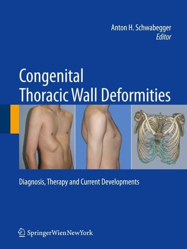Congenital Thoracic Wall Deformities Diagnosis, Therapy and Current Developments