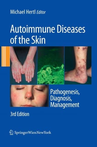 Autoimmune Diseases of the Skin Pathogenesis, Diagnosis, Management