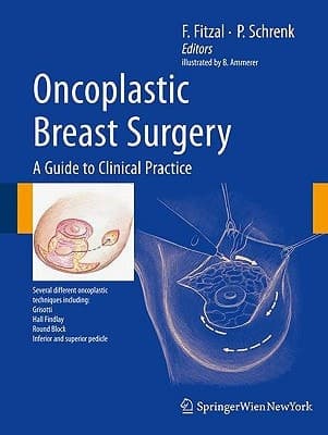 Oncoplastic Breast Surgery A Guide to Clinical Practice