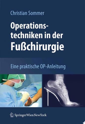 Operationstechniken in der Fußchirurgie Eine praktische OP-Anleitung