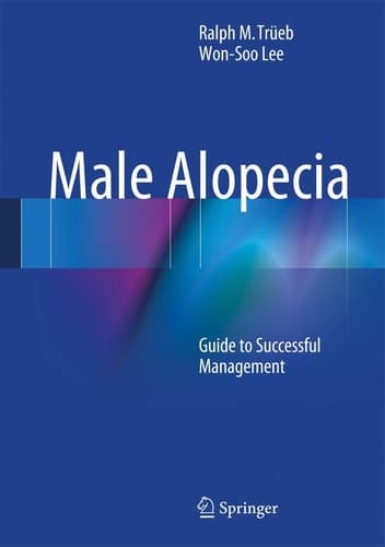 Male Alopecia Guide to Successful Management