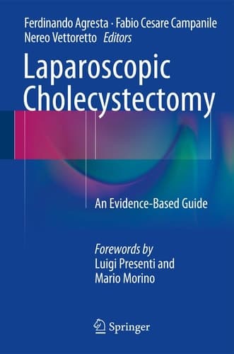 Laparoscopic Cholecystectomy An Evidence-Based Guide
