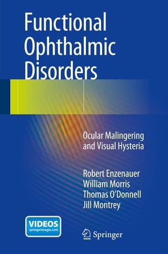 Functional Ophthalmic Disorders Ocular Malingering and Visual Hysteria