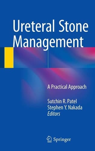 Ureteral Stone Management A Practical Approach