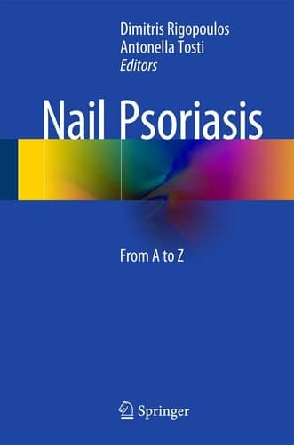 Nail Psoriasis From A to Z