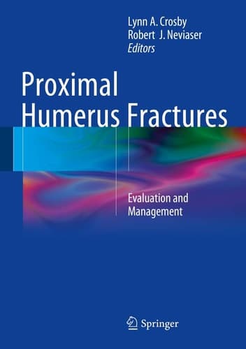 Proximal Humerus Fractures Evaluation and Management