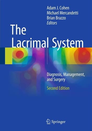 The Lacrimal System Diagnosis, Management, and Surgery, Second Edition