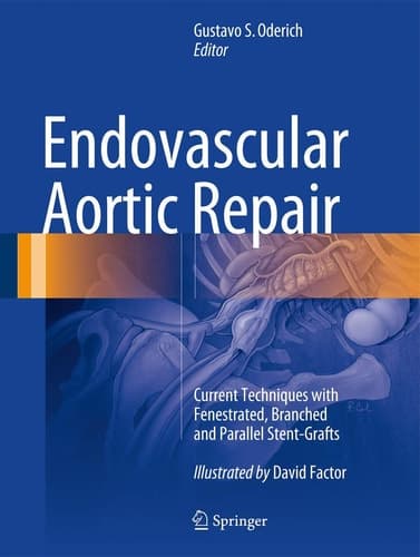 Endovascular Aortic Repair Current Techniques with Fenestrated, Branched and Parallel Stent-Grafts