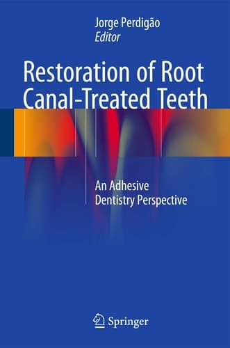 Restoration of Root Canal-Treated Teeth An Adhesive Dentistry Perspective