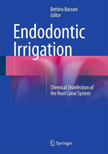 Endodontic Irrigation Chemical disinfection of the root canal system