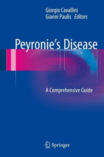 Peyronie’s Disease A Comprehensive Guide