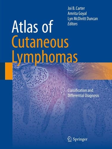 Atlas of Cutaneous Lymphomas Classification and Differential Diagnosis
