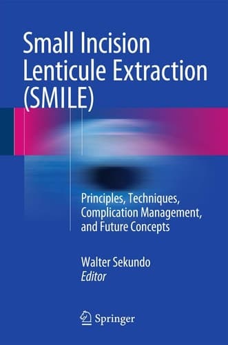 Small Incision Lenticule Extraction (SMILE) Principles, Techniques, Complication Management, and Future Concepts