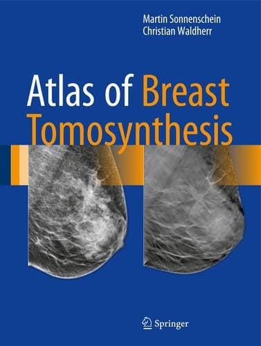 Atlas of Breast Tomosynthesis Imaging Findings and Image-Guided Interventions
