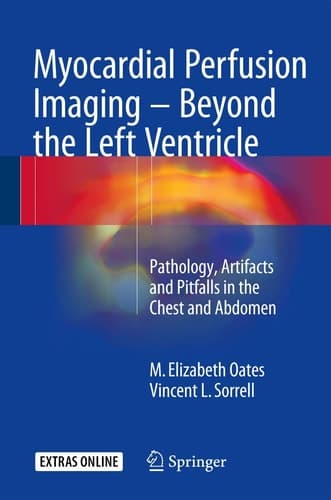 Myocardial Perfusion Imaging - Beyond the Left Ventricle Pathology, Artifacts and Pitfalls in the Chest and Abdomen