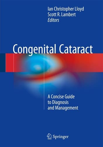 Congenital Cataract A Concise Guide to Diagnosis and Management