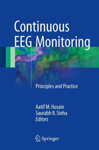 Continuous EEG Monitoring Principles and Practice