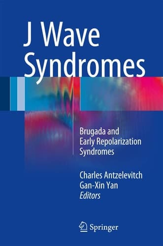 J Wave Syndromes Brugada and Early Repolarization Syndromes