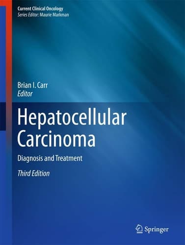 Hepatocellular Carcinoma Diagnosis and Treatment