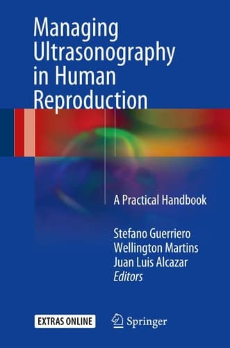 Managing Ultrasonography in Human Reproduction A Practical Handbook