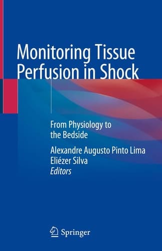 Monitoring Tissue Perfusion in Shock From Physiology to the Bedside
