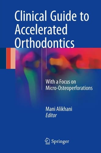 Clinical Guide to Accelerated Orthodontics With a Focus on Micro-Osteoperforations